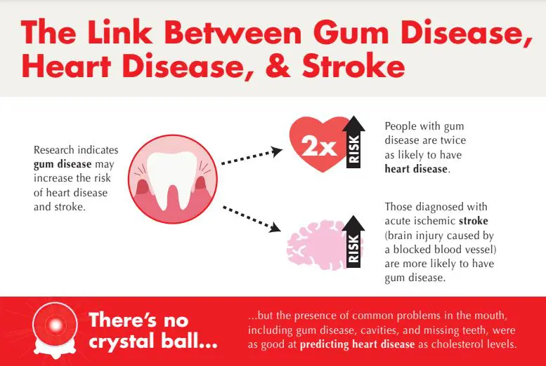 Infographic explaining the link between gum disease, heart disease, and stroke