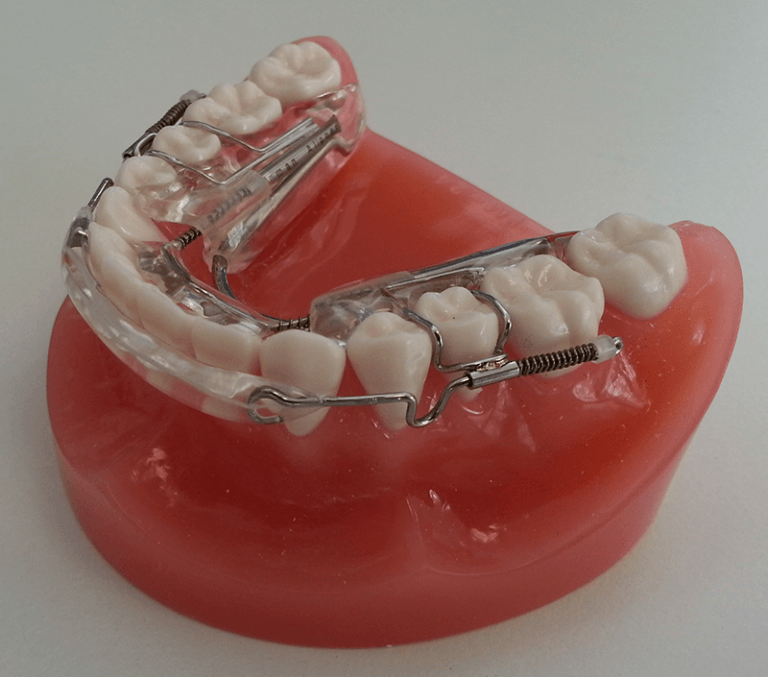 inman_aligner