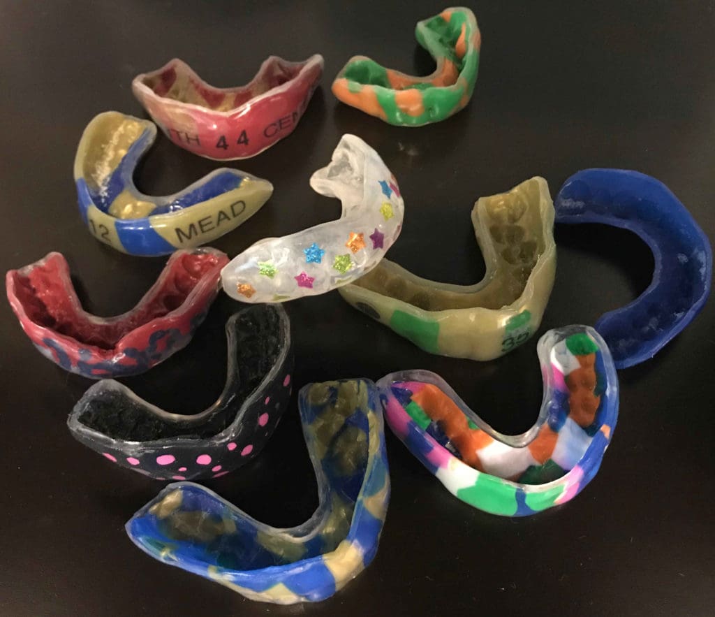 Sports TekFit Mouth guards customized at Chaffin Dental Care, Spokane WA