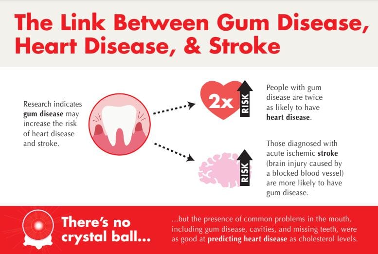 Infographic explaining the link between gum disease, heart disease, and stroke