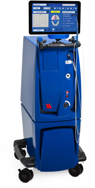 PerioLase dental laser used for laser gum disease treatment at Chaffin Dental Care