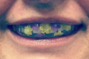 Wearing a Tekfit Sports Mouth Guard designed at Chaffin Dental Care, in Spokane WA